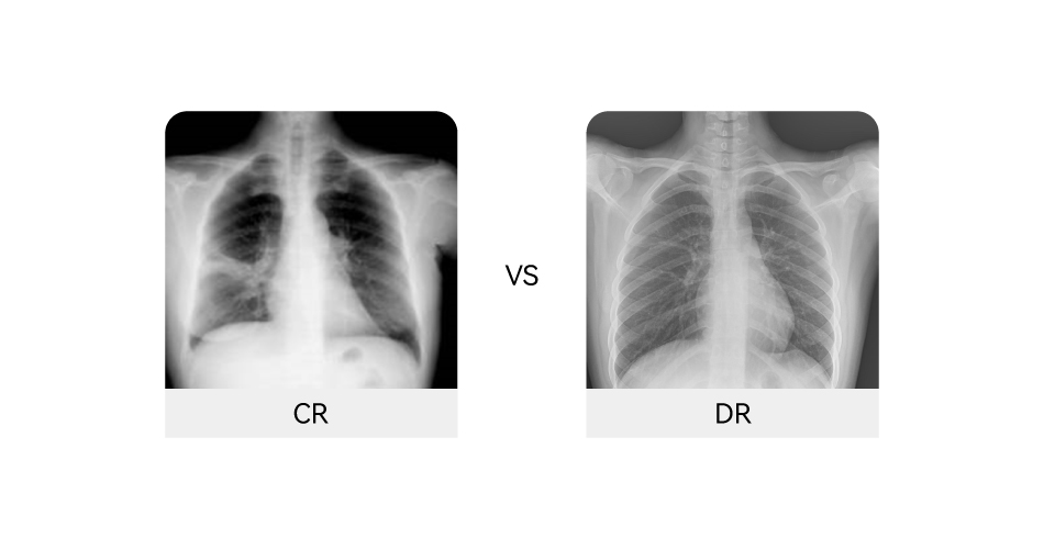 AR、CR VS DR : LEQUEL DEVRAIT ÊTRE VOTRE MEILLEUR CHOIX ?cid=12