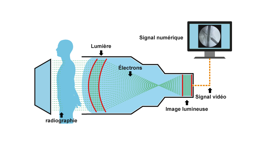 Détecteur à écran plat VS intensificateur d'image : lequel devrait être votre meilleur choix ?cid=12