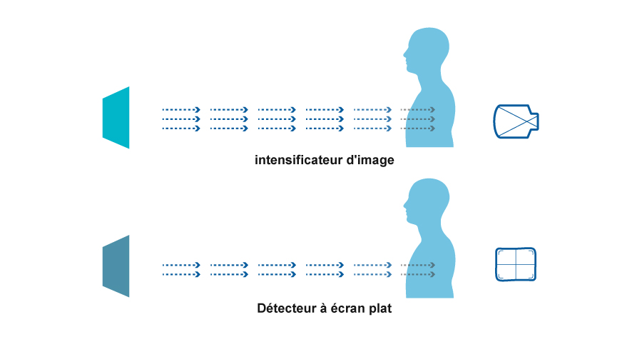 Détecteur à écran plat VS intensificateur d'image : lequel devrait être votre meilleur choix ?cid=12