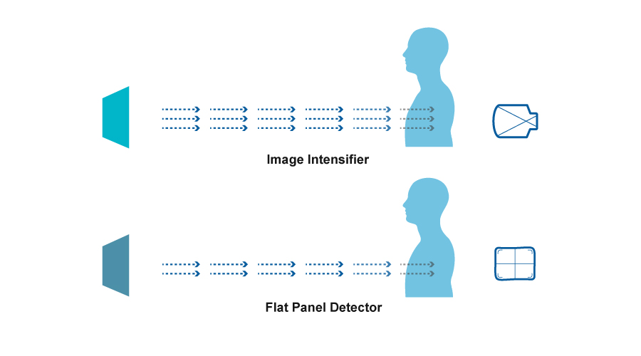 Détecteur de panneau plat vs Intensificateur d'image: lequel devrait être votre meilleur choix? CID = 12